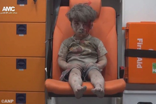 Video gewond jongetje toont oorlogsleed Syrië 