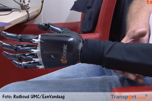 Breingestuurde kunstarm voor voormalig vrachtwagenchauffeur uit Lent [+video]