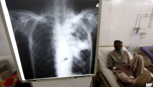 'Wereldwijd veel meer tbc-doden door uitbraak coronavirus'