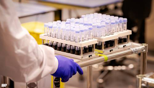 RIVM registreert 11.555 positieve coronatesten, ruim 1000 meer dan woensdag
